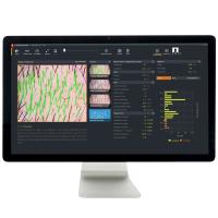 FotoFinder Trichovision Дерматоскоп