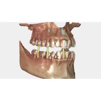 Exocad DICOM viewer - средство просмотра DICOM файлов
