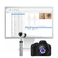 Heine Vision Derma Дерматоскоп