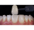 Smile Lite MDP - подсветка для дентальной фотографии, для смартфона Smile Lite MDP - подсветка для дентальной фотографии, для смартфона