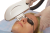 Beijing Toplaser Technology Soft Light W Skin Косметологический лазер