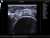 UltraSonix SonixOP Аппарат УЗИ UltraSonix SonixOP Аппарат УЗИ
