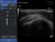 Healcerion Sonon 300L Аппарат УЗИ