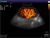 Sonoscape S40 Exp Аппарат УЗИ Sonoscape S40 Exp Аппарат УЗИ