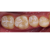 Smile Lite MDP - подсветка для дентальной фотографии, для смартфона Smile Lite MDP - подсветка для дентальной фотографии, для смартфона