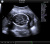 UltraSonix SonixTouch Аппарат УЗИ UltraSonix SonixTouch Аппарат УЗИ