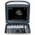 Chison SonoTouch 10 Аппарат УЗИ Chison SonoTouch 10 Аппарат УЗИ