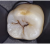 Smile Lite MDP - подсветка для дентальной фотографии, для смартфона Smile Lite MDP - подсветка для дентальной фотографии, для смартфона