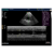 Sonoscape S6V Аппарат УЗИ Sonoscape S6V Аппарат УЗИ
