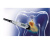 DIAGNOdent pen 2190 - прибор для диагностики раннего и скрытого кариеса DIAGNOdent pen 2190 - прибор для диагностики раннего и скрытого кариеса