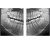 RAYSCAN Symphony Alpha SC - ортопантомограф с цефалостатом, 26х24 см RAYSCAN Symphony Alpha SC - ортопантомограф с цефалостатом, 26х24 см
