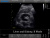 Chison SonoTouch 10 Аппарат УЗИ Chison SonoTouch 10 Аппарат УЗИ