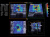 Super Sonic Imagine Aixplorer Аппарат УЗИ Super Sonic Imagine Aixplorer Аппарат УЗИ